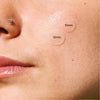 SOS Pimple Patches Day & Night