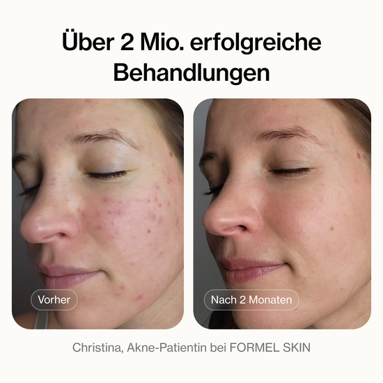 Über 2 Mio. erfolgreiche Behandlungen – Vorher/Nachher