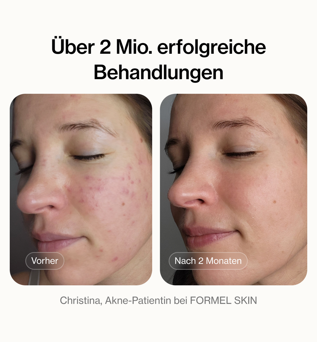 Über 2 Mio. erfolgreiche Behandlungen – Vorher/Nachher