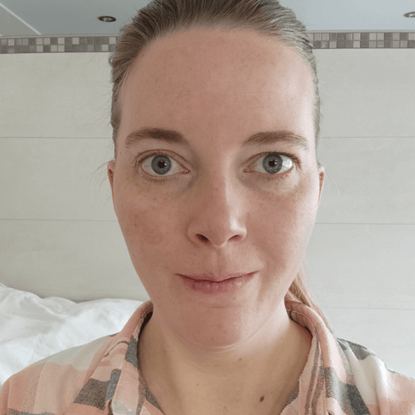 Sandra nachher – Rosacea, nach 3 Monaten